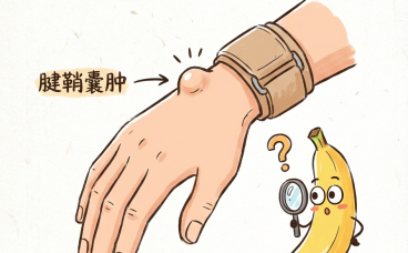 腱鞘囊肿:手腕上那个”会动的小鼓包”,到底是什么来头?